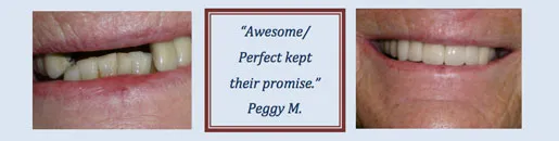 Patient Testimonial from Peggy M.