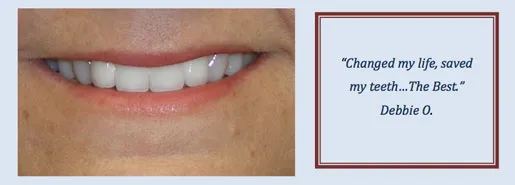 Patient Testimonial from Debbie O.